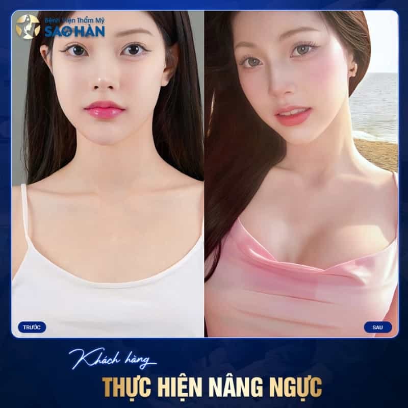 thẩm mỹ viện nào nâng ngực uy tín
